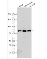PFKM Polyclonal antibody proteintech 55028-1-AP