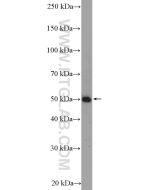 TNFR1/CD120a Polyclonal antibody proteintech 21574-1-AP