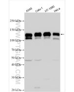 Integrin Beta 1/CD29 Polyclonal antibody proteintech 12594-1-AP