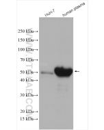 Angiotensinogen/AGT Polyclonal antibody proteintech 11992-1-AP