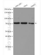 HRD1/SYVN1 Polyclonal antibody proteintech 13473-1-AP