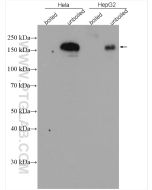 P glycoprotein Polyclonal antibody proteintech 22336-1-AP