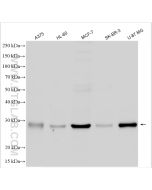 PSPH Polyclonal antibody proteintech 14513-1-AP