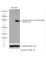 Phospho-ERK1/2 (Thr202/Tyr204) Polyclonal antibody proteintech 28733-1-AP