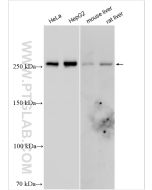 FASN Polyclonal antibody proteintech 10624-2-AP
