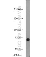 Albumin Polyclonal antibody proteintech 16475-1-AP