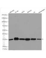 MTAP Polyclonal antibody proteintech 11475-1-AP