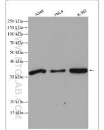 DKK1 Polyclonal antibody proteintech 21112-1-AP