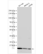 S100A11 Polyclonal antibody proteintech 10237-1-AP