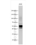 Carbonic Anhydrase IX/CA9 Polyclonal antibody proteintech 11071-1-AP