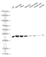 RPLP0 Polyclonal antibody proteintech 11290-2-AP