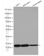 TIPE2/TNFAIP8L2 Polyclonal antibody proteintech 15940-1-AP