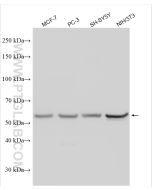 ESR2 Polyclonal antibody proteintech 14007-1-AP