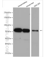 NDUFS1 Polyclonal antibody proteintech 12444-1-AP