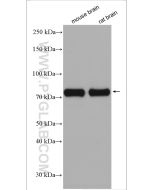 DRP1 (C-terminal) Polyclonal antibody proteintech 12957-1-AP