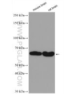 GAD65 Polyclonal antibody proteintech 20746-1-AP