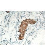 Collagen Type II Polyclonal antibody proteintech 28459-1-AP