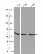 TGF beta 2-Specific Polyclonal antibody proteintech 19999-1-AP