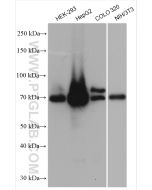 ACSL4/FACL4 Polyclonal antibody proteintech 22401-1-AP