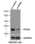 PCNA Polyclonal antibody proteintech 10205-2-AP
