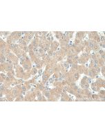 G6PC Polyclonal antibody proteintech 22169-1-AP