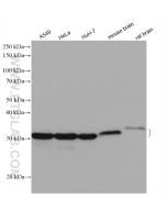 METTL1 Polyclonal antibody proteintech 14994-1-AP