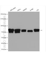 MIRO2 Polyclonal antibody proteintech 11237-1-AP