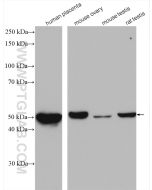 CYP11A1 Polyclonal antibody proteintech 13363-1-AP