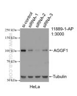 AGGF1 Polyclonal antibody proteintech 11889-1-AP
