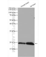 Alpha Synuclein Polyclonal antibody proteintech 10842-1-AP