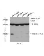 Histone H1.2 Polyclonal antibody proteintech 19649-1-AP