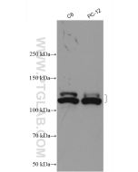 NEDD4L Polyclonal antibody proteintech 13690-1-AP