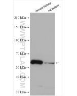 NOX1 Polyclonal antibody proteintech 17772-1-AP