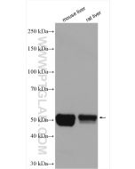 CYP2E1-Specific Polyclonal antibody proteintech 19937-1-AP