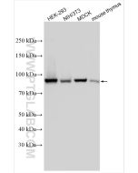 IFT88 Polyclonal antibody proteintech 13967-1-AP