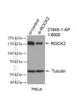 ROCK2(middle) Polyclonal antibody proteintech 21645-1-AP