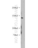 PTCH2 Polyclonal antibody proteintech 55091-1-AP