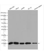 FIS1 Polyclonal antibody proteintech 10956-1-AP