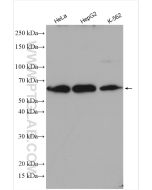 FASTKD2 Polyclonal antibody proteintech 17464-1-AP