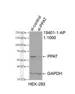PPAT Polyclonal antibody proteintech 15401-1-AP