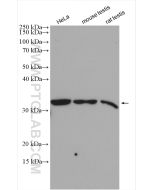 GOLPH3 Polyclonal antibody proteintech 19112-1-AP