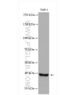 CHI3L1/YKL40 Polyclonal antibody proteintech 12036-1-AP