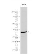 CDC6 Polyclonal antibody proteintech 11640-1-AP