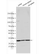 RAB11A/B Polyclonal antibody proteintech 15903-1-AP