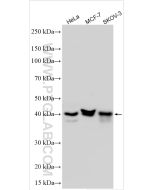 IGFBP3 Polyclonal antibody proteintech 10189-2-AP