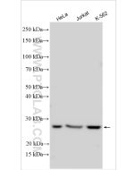 EIF4E Polyclonal antibody proteintech 11149-1-AP