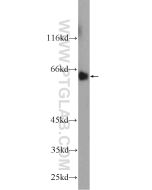 MTF1 Polyclonal antibody proteintech 25383-1-AP
