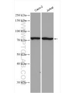 ACSS1 Polyclonal antibody proteintech 17138-1-AP