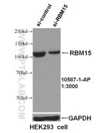 RBM15 Polyclonal antibody proteintech 10587-1-AP
