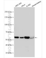 Sestrin 2 Polyclonal antibody proteintech 10795-1-AP